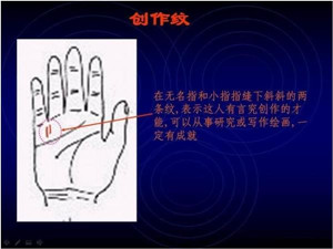 手掌纹与健康，看手掌纹知健康15